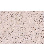 Anti-DDX46 Antibody, Rabbit Polyclonal sinobiological 203515-T10