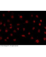Anti-FRA1/Fosl1 Antibody, Rabbit Polyclonal sinobiological 101123-T38