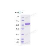 SARS-CoV-2 (2019-nCoV) Nucleocapsid-His recombinant Protein sinobiological 40588-V08B