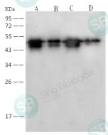 SARS-CoV/SARS-CoV-2 Nucleocapsid Antibody, Rabbit MAb sinobiological 40143-R001