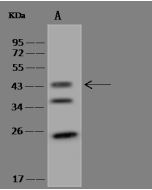 Anti-LIAS Antibody, Rabbit Polyclonal sinobiological 204157-T44
