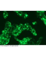 Recombinant Anti-Albumin Antibody, Rabbit Monoclonal sinobiological 68001-R101