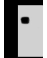 SARS-CoV-2 (2019-nCoV) Nucleocapsid Antibody, Rabbit MAb sinobiological 40588-RB89