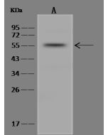 Anti-DNTT/TDT Antibody, Rabbit Polyclonal sinobiological 310192-T32