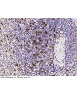Recombinant Anti-CD8 beta Antibody, Rabbit Monoclonal sinobiological 11031-R039