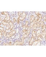 Anti-CEP68 Antibody, Rabbit Polyclonal sinobiological 203725-T08