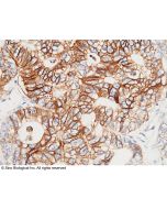 Anti-GPA33/A33 Antibody, Rabbit Polyclonal sinobiological 11277-RP02