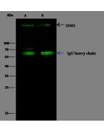 Anti-DDR1 Antibody, Rabbit Polyclonal sinobiological 10730-RP02