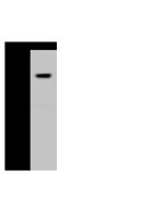 Anti-M-CSFR/CSF1R Antibody, Rabbit Polyclonal sinobiological 10161-T58