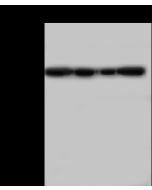 Anti-Catalase Antibody, Rabbit Polyclonal sinobiological 201710-T36