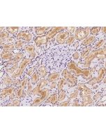 Anti-ALDH6A1 Antibody, Rabbit Polyclonal sinobiological 203527-T08