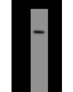 Anti-CRHR2 Antibody, Rabbit Polyclonal sinobiological 206176-T32