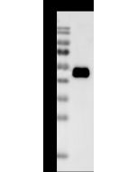 Vaccinia Virus B18R / B19R Antibody, Rabbit PAb, Antigen Affinity Purified sinobiological 40020-T62