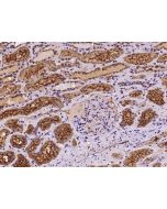 Anti-MYO10 Antibody, Rabbit Polyclonal sinobiological 204795-T08