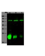 Anti-CARHSP1 Antibody, Rabbit Polyclonal sinobiological 14333-T52