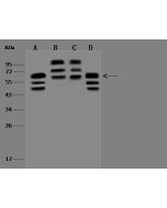 Anti-Beclin 1/BECN1 Antibody, Rabbit Polyclonal sinobiological 201473-T38
