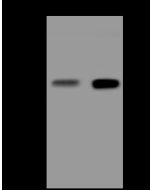 Anti-IL-3R Beta/IL3RB Antibody, Rabbit Polyclonal sinobiological 310680-T40