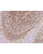 Anti-CR1/CD35 Antibody, Rabbit Polyclonal sinobiological 202707-T08