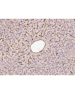 Anti-Endoglin/CD105 Antibody, Rabbit Polyclonal sinobiological 50407-T24
