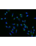 Anti-GALNT7 Antibody, Rabbit Polyclonal sinobiological 15197-T26