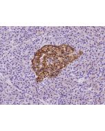 Anti-CD99 Antibody, Rabbit Polyclonal sinobiological 106789-T10