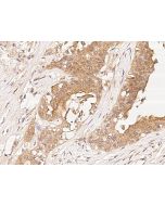 Anti-Factor D Antibody, Rabbit Polyclonal sinobiological 310726-T08