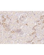 Anti-IQGAP1 Antibody, Rabbit Polyclonal sinobiological 205511-T08