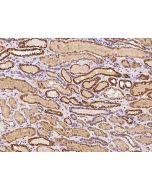 Anti-C1orf69 Antibody, Rabbit Polyclonal sinobiological 204569-T08