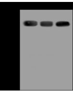 Anti-GPKOW Antibody, Rabbit Polyclonal sinobiological 202367-T46