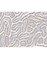 Anti-FH/Fumarate Hydratase Antibody, Rabbit Polyclonal sinobiological 107186-T08