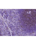 Recombinant Anti-CD8 alpha Antibody, Rabbit Monoclonal sinobiological 50389-R309