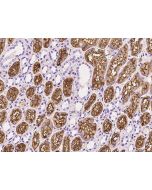 Recombinant Anti-CD13 Antibody, Rabbit Monoclonal sinobiological 10051-R422