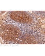 Anti-CD82 Antibody, Mouse Monoclonal sinobiological 12275-MM01