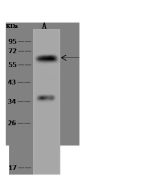 Anti-Adracalin Antibody, Rabbit Polyclonal sinobiological 200392-T34