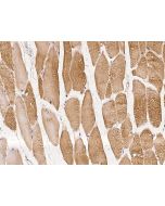Anti-KLHL40 Antibody, Rabbit Polyclonal sinobiological 206303-T08
