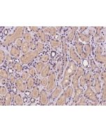 Anti-COMMD10 Antibody, Rabbit Polyclonal sinobiological 200637-T08