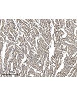Anti-MYH7 Antibody, Rabbit Polyclonal sinobiological 203124-T08