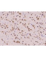 Anti-CGREF1/CGR11 Antibody, Rabbit Polyclonal sinobiological 201464-T08