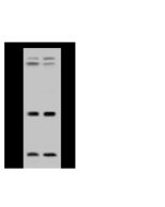 Anti-FXN/Frataxin Antibody, Rabbit Polyclonal sinobiological 102315-T40