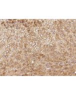 Anti-CNST Antibody, Rabbit Polyclonal sinobiological 207534-T08