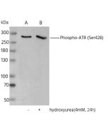 Phospho-ATR (Ser428) Antibody, Rabbit MAb sinobiological 111263-R0025