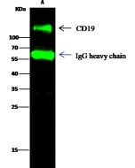 Recombinant Anti-CD19 Antibody, Rabbit Monoclonal sinobiological 11880-R410