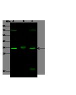 Anti-CDK4 Antibody, Rabbit Polyclonal sinobiological 10732-T62