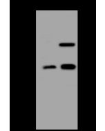 Anti-ATP6V1D/Atp6m Antibody, Rabbit Polyclonal sinobiological 200459-T44