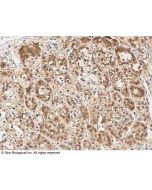 Anti-Cyclin B2 Antibody, Rabbit Polyclonal sinobiological 101500-T10