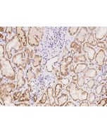 Anti-GLYATL1 Antibody, Rabbit Polyclonal sinobiological 205090-T08