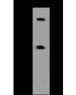 Anti-FBXL4 Antibody, Rabbit Polyclonal sinobiological 206492-T32