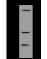 Anti-ARHGAP19 Antibody, Rabbit Polyclonal sinobiological 205226-T44