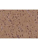 Anti-BMF Antibody, Rabbit Polyclonal sinobiological 200740-T10