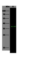 Anti-Annexin A8 Antibody, Rabbit Polyclonal sinobiological 15421-T48